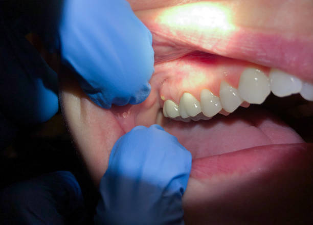 Best Emergency Dental Surgery in Mianna, AR